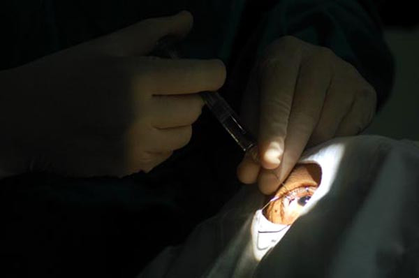 Mais um mutirão para a realização de cirurgias de catarata vai ser realizado (Foto: Divulgação)