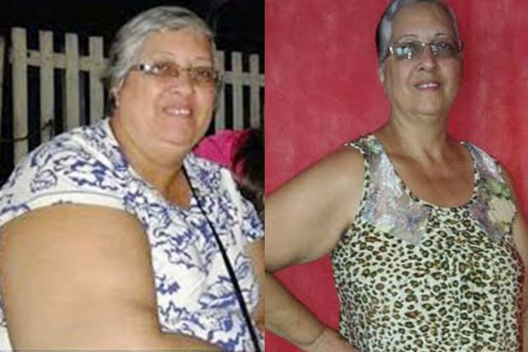 A professora aposentada Rita de Cássia Azevedo Sá, 58 anos, operou em julho deste ano e perdeu 25 quilos até o momento (Foto: Superintendência de Comunicação)